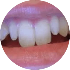 Length & Width of the Tooth