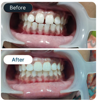 Smile Result